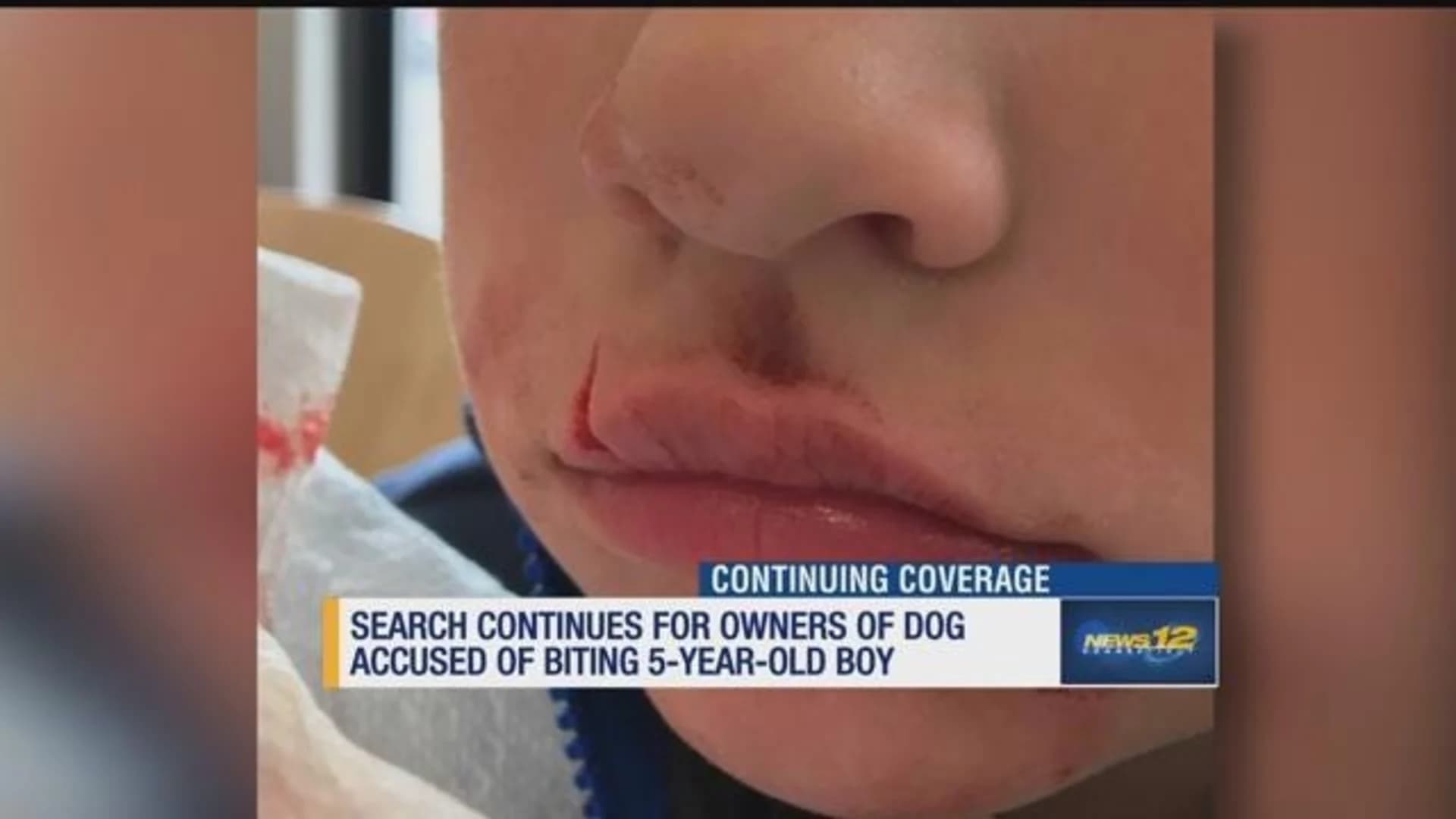 Father pleads for owners of dog accused of biting son to come forward